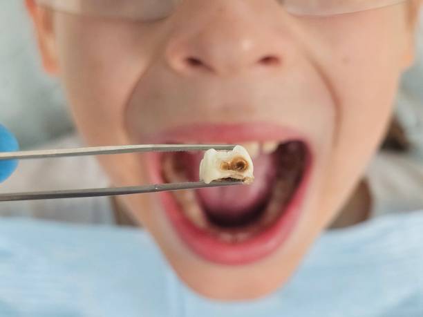 Best Emergency Broken Tooth Repair in Marrero, LA